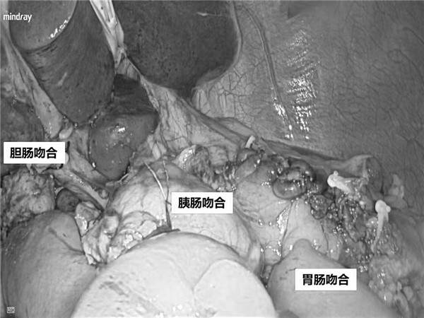 微信图片_20220721142829.jpg 微信图片_20220721142829.jpg