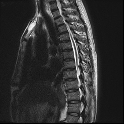 图2 胸椎.jpg