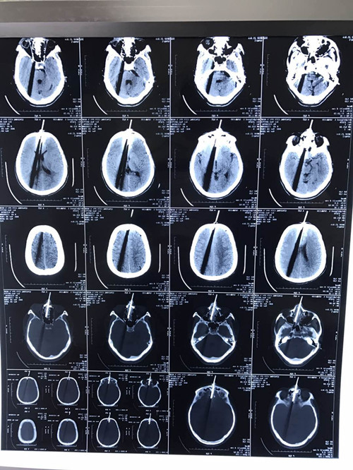 0305_2_副本.jpg 0305_2_副本.jpg