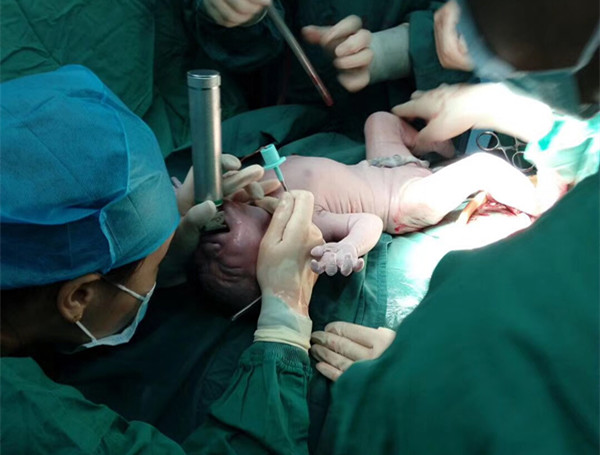 webwxgetmsgimg (1)_副本.jpg