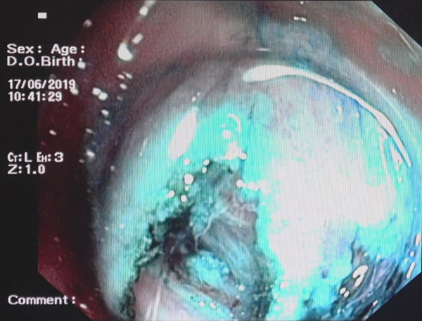 2019.7.25 报道图一_副本.jpg