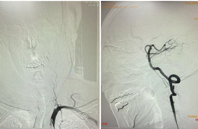 initpintu_副本.jpg initpintu_副本.jpg