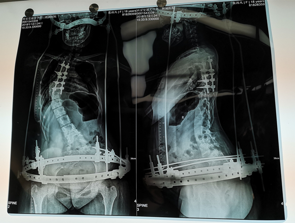 f75a8adeb2f0e994d9fb650a1f832ca_副本.jpg f75a8adeb2f0e994d9fb650a1f832ca_副本.jpg