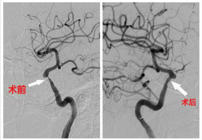 se031_meitu_2_meitu_3.jpg se031_meitu_2_meitu_3.jpg