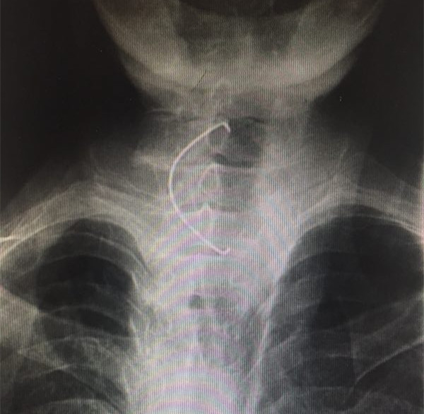 webwxgetmsgimg_副本.jpg webwxgetmsgimg_副本.jpg