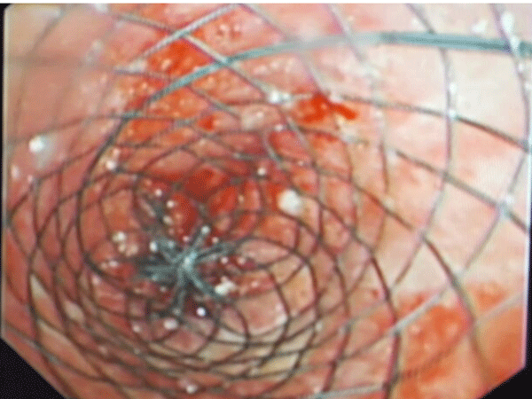 YS@71SV8073VK8VI)7S)6_D_副本.png YS@71SV8073VK8VI)7S)6_D_副本.png