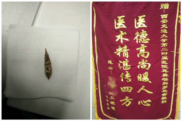 3-枣核_副本.jpg 3-枣核_副本.jpg