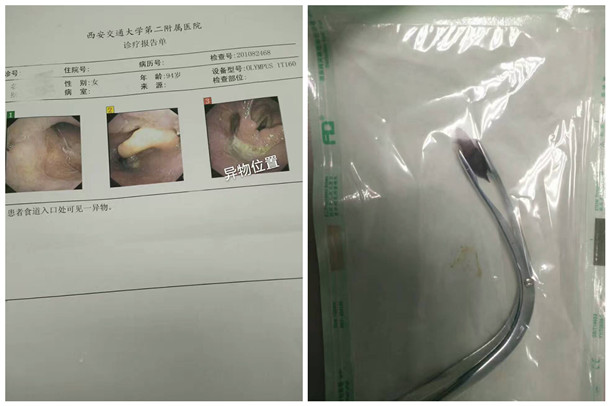 1-患者电子喉镜检查结果_副本.jpg 1-患者电子喉镜检查结果_副本.jpg