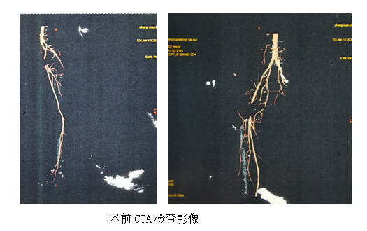 QQ截图20200707155805.png QQ截图20200707155805.png