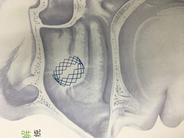 2017-07-11 154325.jpg