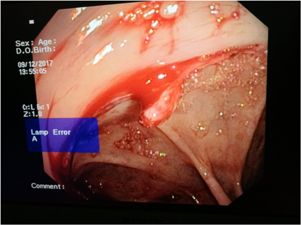 1512984624(1).png 1512984624(1).png