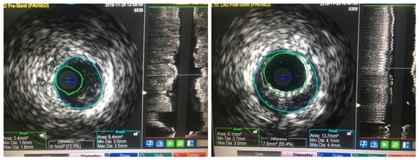 1128_2_副本.jpg 1128_2_副本.jpg