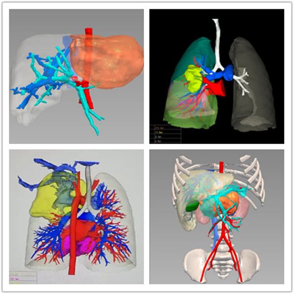 图片2_副本.png 图片2_副本.png