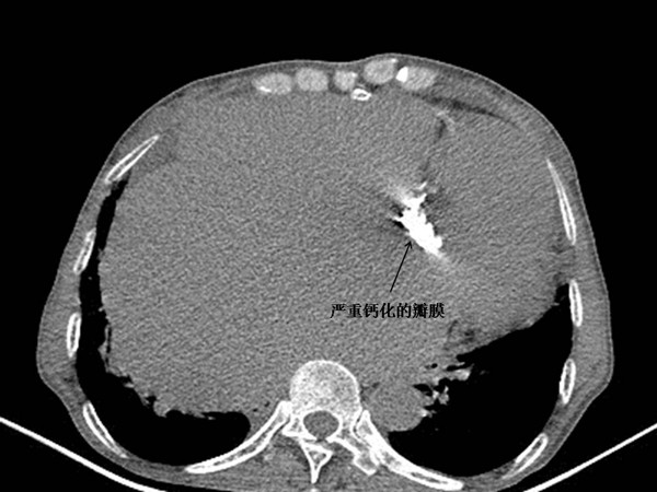 图二_副本.jpg 图二_副本.jpg