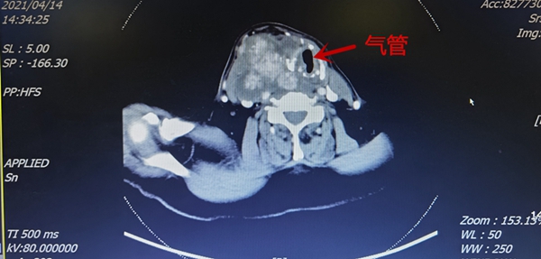 影像学资料_副本.jpg 影像学资料_副本.jpg