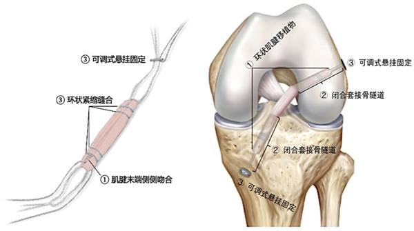 图2_副本.png 图2_副本.png